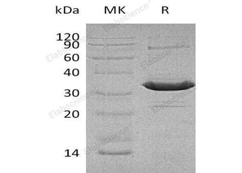 Recombinant Human ATF1 Protein (His Tag) - ABMIUM