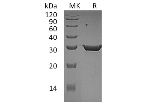 Recombinant Human 15-PGDH Protein (His Tag) - ABMIUM