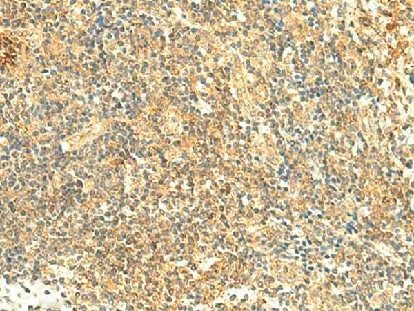 Anti-Human/Mouse ARL4D Antibody