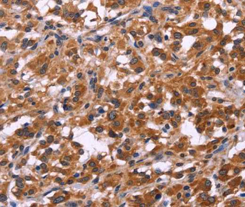 Anti-Human SPATA7 Antibody