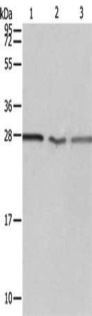 Anti-Human/Mouse/Rat PSMD9 Antibody - ABMIUM