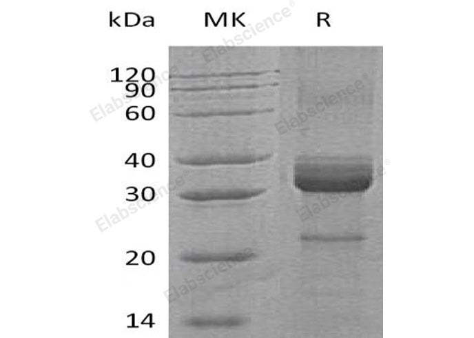 Recombinant Human Haptoglobin/Zonulin Protein (aa 145-406, His Tag) - ABMIUM