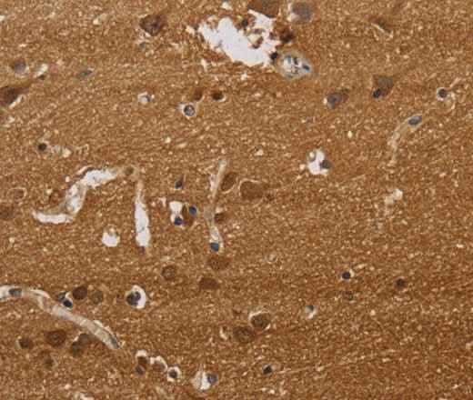 Anti-Human/Mouse/Rat ELAVL2 Antibody