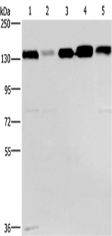 Anti-Human CEP97 Antibody - ABMIUM