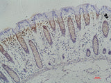 Anti-Human Galectin-3 Antibody - ABMIUM