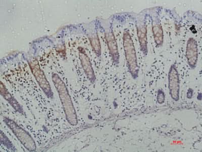 Anti-Human Galectin-3 Antibody - ABMIUM