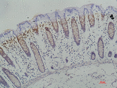 Anti-Human Galectin-3 Antibody - ABMIUM