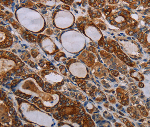 Anti-Human/Rat FABP3 Antibody - ABMIUM