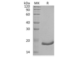 Recombinant Human Interferon α-6/IFNA6 Protein (His Tag) - ABMIUM