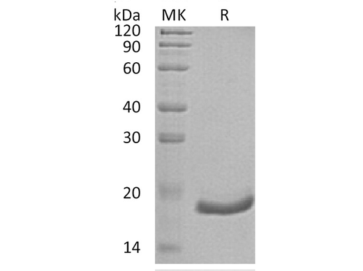 Recombinant Human Interferon α-6/IFNA6 Protein (His Tag) - ABMIUM