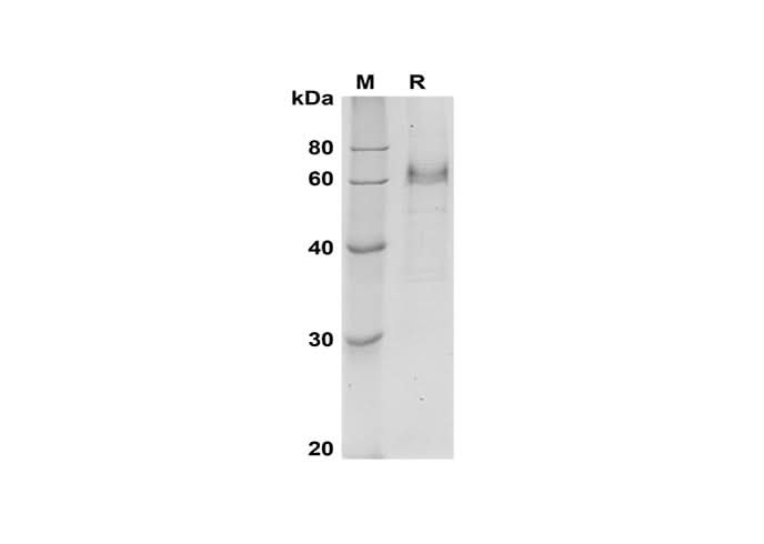 SDS-PAGE analysis of Human DLL4 proteins, 2 μg/lane of Recombinant Human DLL4 proteins was resolved with SDS-PAGE under reducing conditions, showing bands at 60-65 kDa.