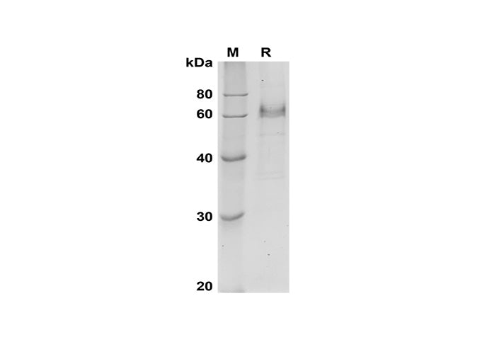 SDS-PAGE analysis of Human DLL4 proteins, 2 μg/lane of Recombinant Human DLL4 proteins was resolved with SDS-PAGE under reducing conditions, showing bands at 60-65 kDa.