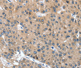 Anti-Human/Mouse DSC1 Antibody - ABMIUM