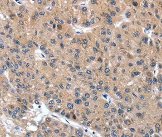 Anti-Human/Mouse DSC1 Antibody
