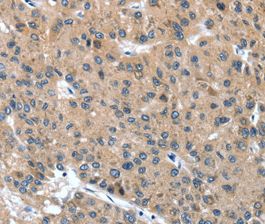 Anti-Human/Mouse DSC1 Antibody - ABMIUM