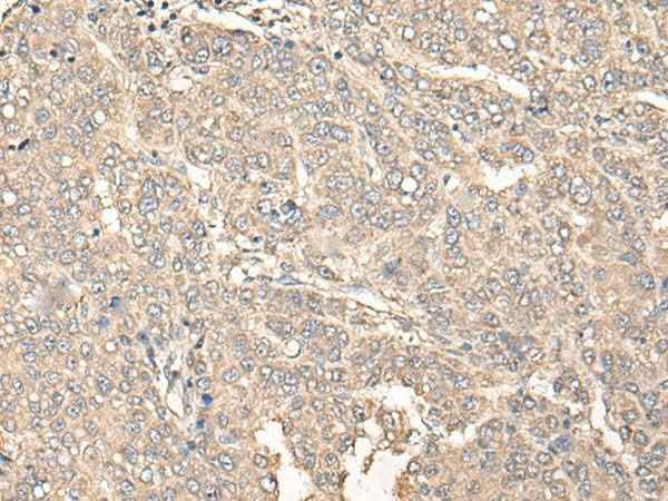 Anti-Human C12orf40 Antibody