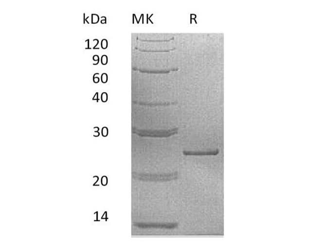 Recombinant Human Prolactin/PRL Protein - ABMIUM