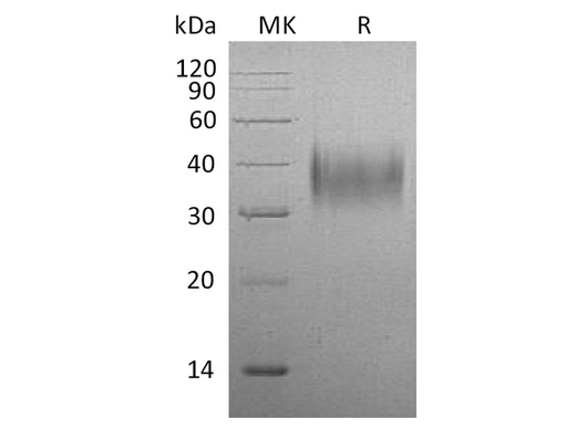 Recombinant Mouse CD16/FCGR3 Protein (His Tag) - ABMIUM