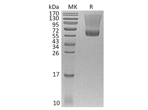 Recombinant Human Decorin Protein (Human Cells, His Tag) - ABMIUM