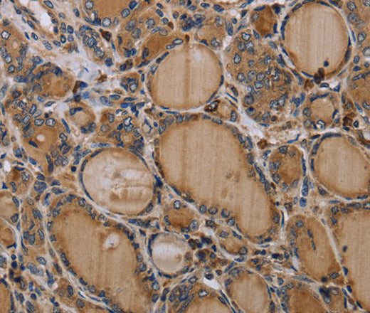 Anti-Human NLRP4 Antibody - ABMIUM