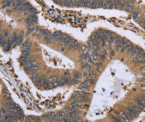 Anti-Human/Mouse GADD45B Antibody