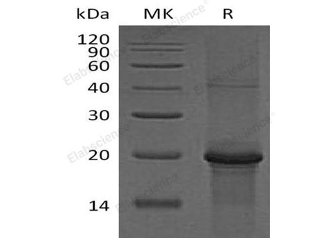 Recombinant Human PKC epsilon/PKCE Protein (His Tag) - ABMIUM
