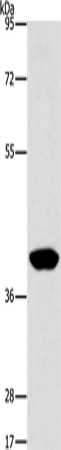 Anti-Human/Mouse AGXT2L2 Antibody - ABMIUM