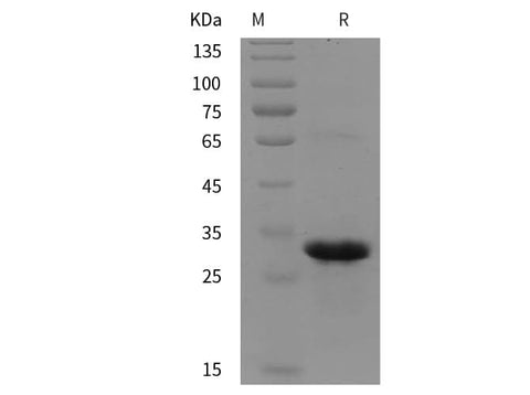 SDS-PAGE analysis of Human RAB5B proteins, 2 μg/lane of Recombinant Human RAB5B proteins was resolved with SDS-PAGE under reducing conditions, showing bands at 30 kDa.