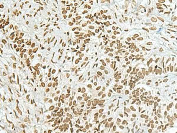 Anti-Human/Mouse HAS1 Antibody