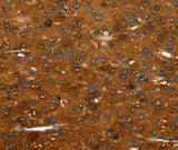 Anti-Human/Mouse FGFR3 Antibody - ABMIUM