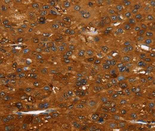 Anti-Human/Mouse FGFR3 Antibody