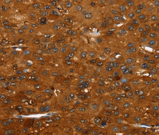 Anti-Human/Mouse FGFR3 Antibody - ABMIUM