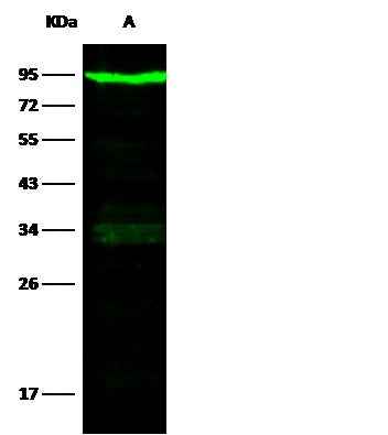 Anti-Human TFRC Antibody [B282] - ABMIUM