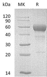 Recombinant Mouse FAS/TNFRSF6 Protein (Fc Tag) - ABMIUM