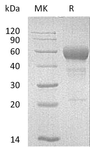 Recombinant Mouse FAS/TNFRSF6 Protein (Fc Tag) - ABMIUM