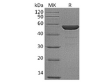 Recombinant Human NSE/ENO2 Protein (His Tag) - ABMIUM