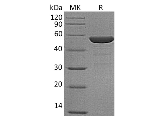 Recombinant Human NSE/ENO2 Protein (His Tag) - ABMIUM