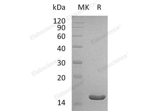 Recombinant Human THEM2/ACOT13 Protein (His Tag) - ABMIUM