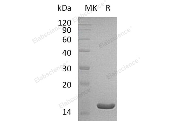 Recombinant Human THEM2/ACOT13 Protein (His Tag) - ABMIUM