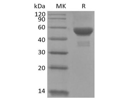 Recombinant Human Carbonic Anhydrase IX/CA9 (C-6His) - ABMIUM
