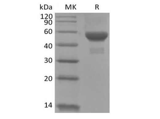 Recombinant Human Carbonic Anhydrase IX/CA9 (C-6His) - ABMIUM