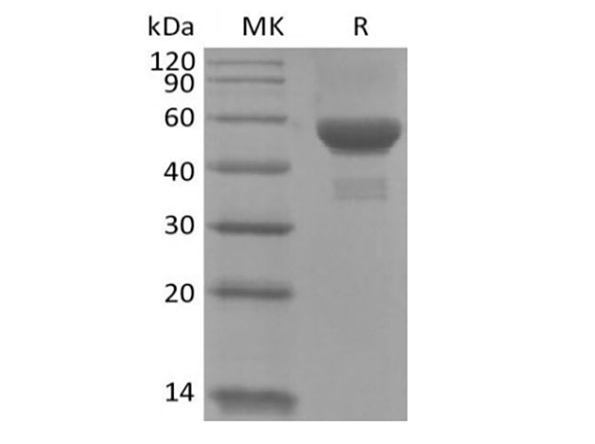 Recombinant Human Carbonic Anhydrase IX/CA9 (C-6His) - ABMIUM