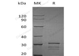 Recombinant Human IPPI2/IDI2 Protein (His Tag) - ABMIUM