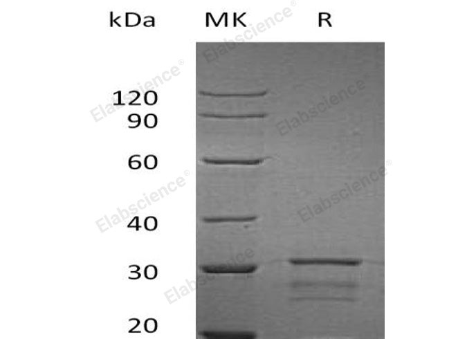 Recombinant Human IPPI2/IDI2 Protein (His Tag) - ABMIUM