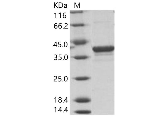 Recombinant EBOV (subtype Bundibugyo, strain Uganda 2007) VP40 / Matrix protein VP40 Protein (His Tag) - ABMIUM
