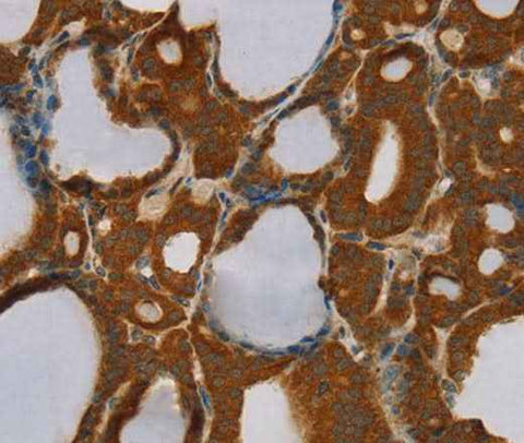 Anti-Human PARP3 Antibody