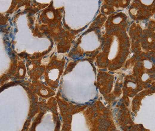 Anti-Human PARP3 Antibody