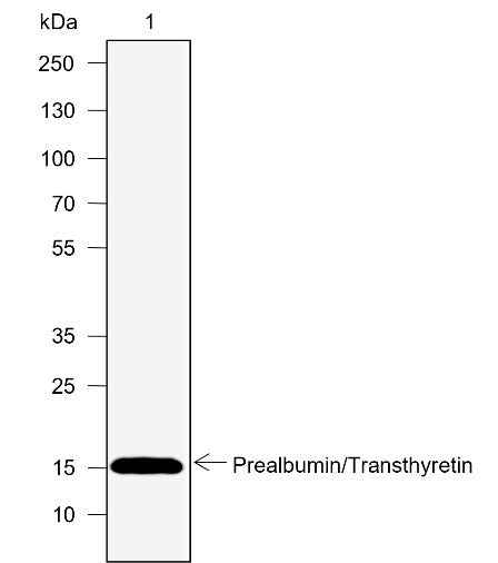 Anti-Human Prealbumin/Transthyretin Antibody [A768] - ABMIUM