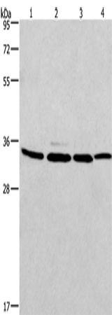 Anti-Human MAD2L1BP Antibody - ABMIUM