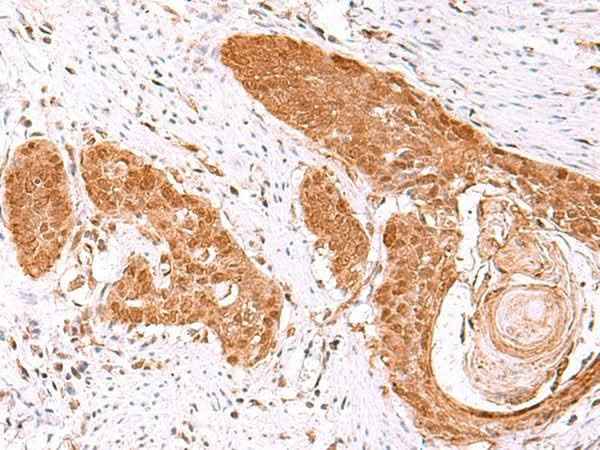 Anti-Human/Mouse/Rat FDPS Antibody